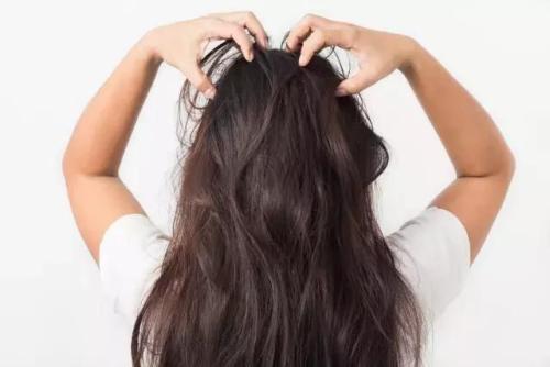 四天不洗头洗头掉了100多根头发,洗头就掉头发不洗头不掉为什么