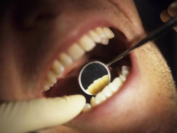 成人矫正期间牙齿松动正常吗,成年人牙齿矫正会松动吗