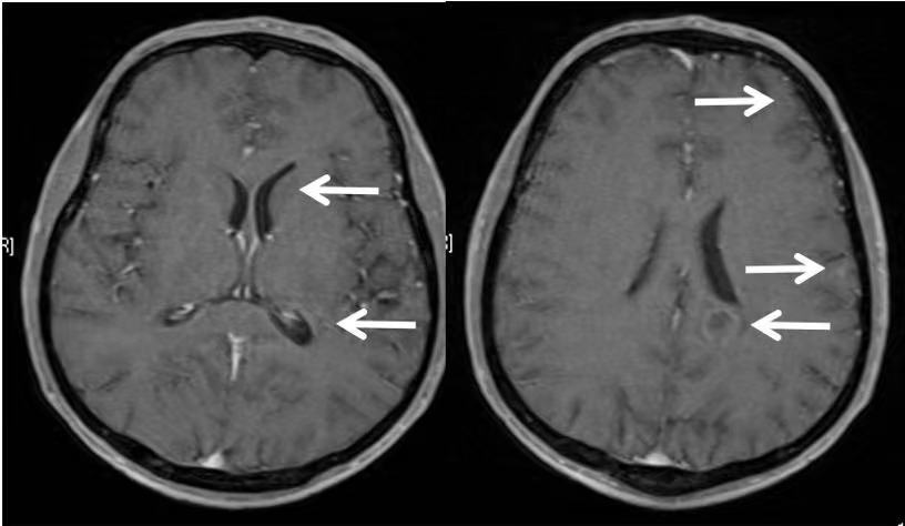 绁炶嵂鍥戒骇,鑽鎵撴灦鐗囨