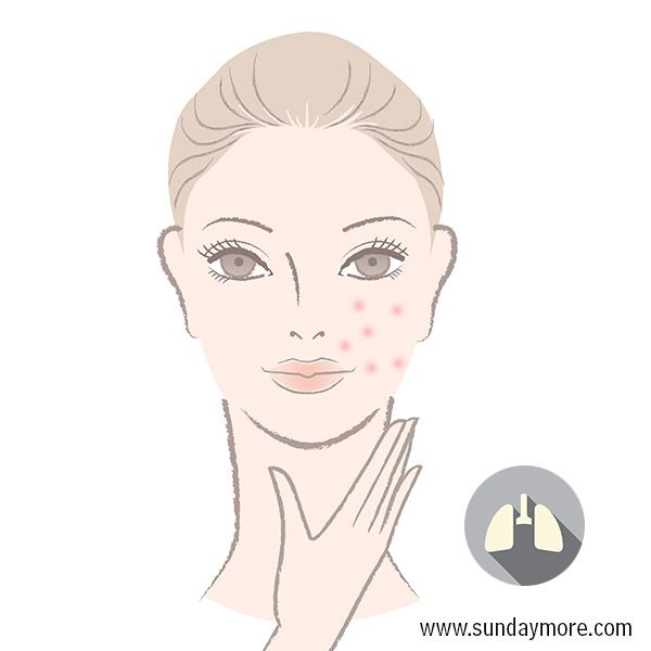 暗疮最好的消除方法 (暗疮印最佳治疗方法)