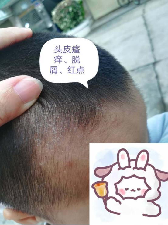 反复腹泻大便不成形,小孩拉肚子肠道功能紊乱多久能好