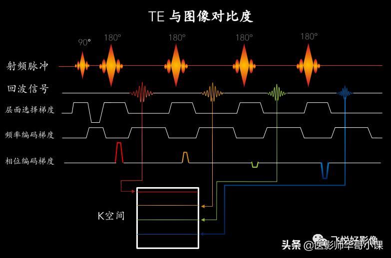 飞利浦磁共振图像操作,飞利浦磁共振成像序列及应用