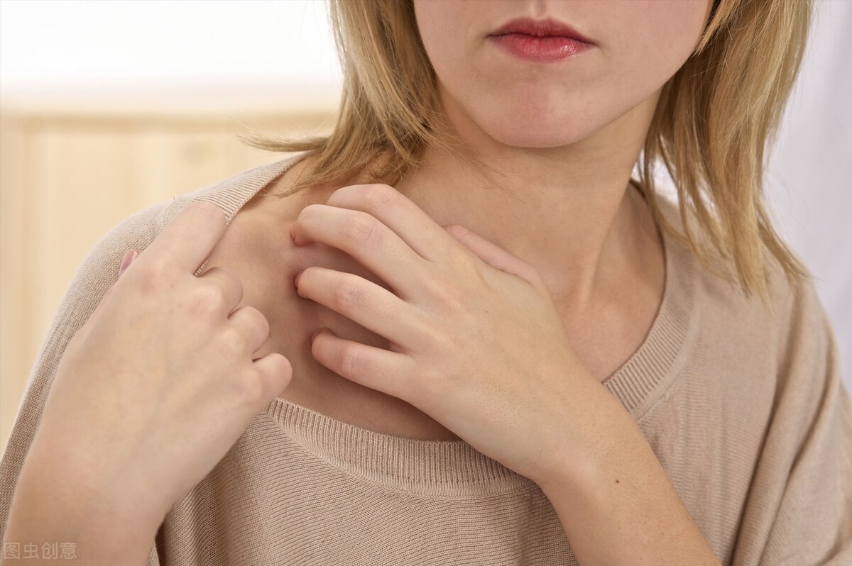 更年期女性瘙痒症的发病原因及治疗