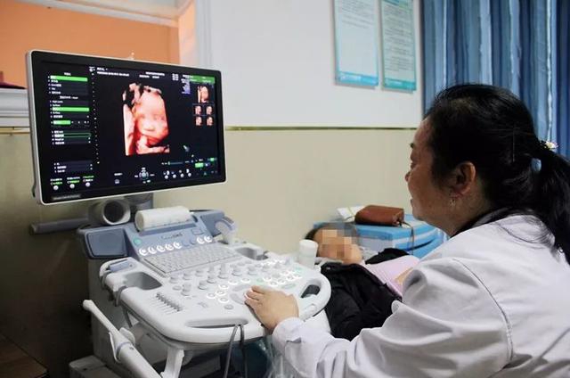 开立医疗最新利好,开立医疗收益怎么样