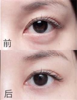 橄榄日记防脱育发液,橄榄日记修复霜