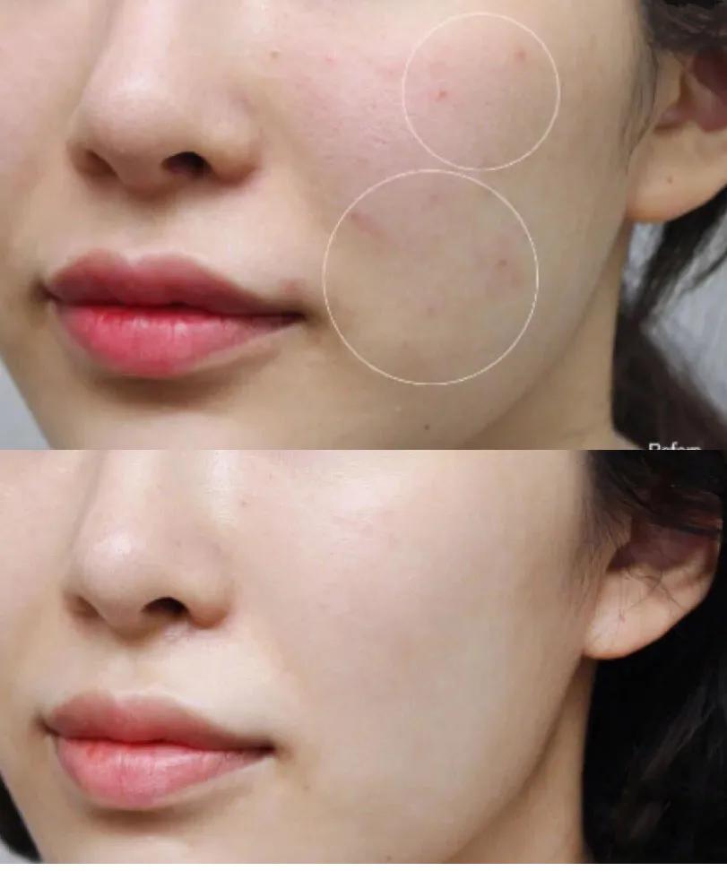 「好评反馈来啦」疯狂打call，实力表白｜为什么*干粉冻**这么受欢迎