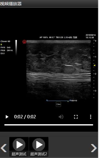鍖诲褰卞儚鍣ㄦ潗灞曠ず瑙嗛,瓒呮竻鍖诲褰卞儚