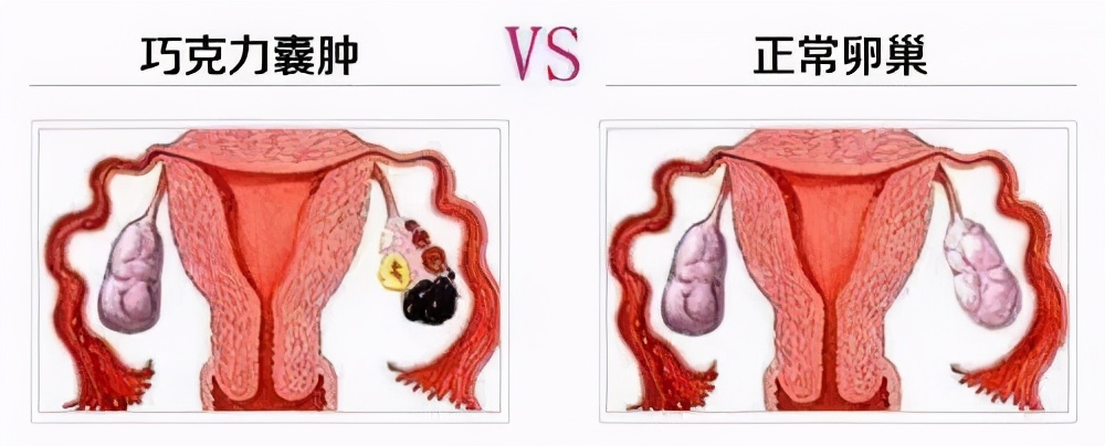 女性出现这些情况要注意,女性要警惕这种病
