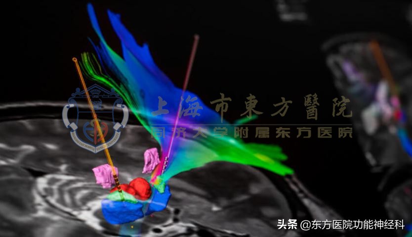 有哪些特殊的治愈方式,得了精神病最有效的方法