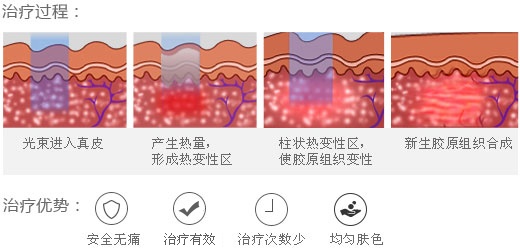 剖腹产疤痕怎么快速消除小妙招,一白遮百丑的调理方法