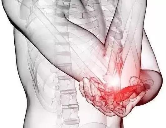 为什么不会打网球还能患上网球肘,不打网球的人会患上网球肘吗