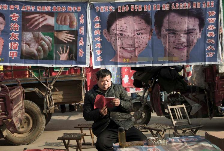 祛痣最安全的办法,祛痣怕留疤怎么办