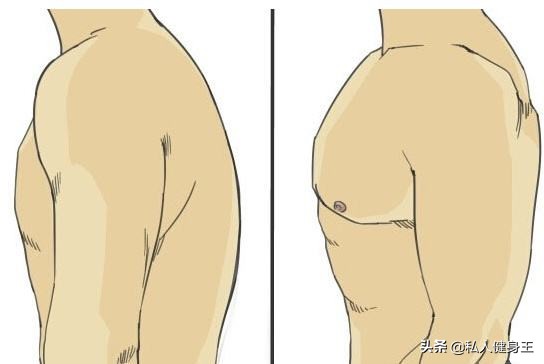 矫正圆肩的6大经典动作,圆肩驼背胸椎高怎么矫正