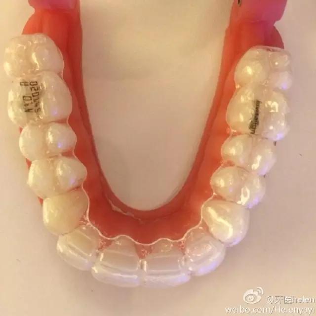 helen鐗欑涓績鍥剧墖,helen榻跨