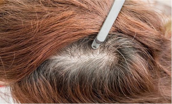 黛森白发养护机构成都,黛森美发机构