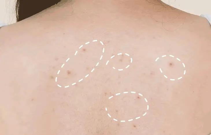 水压小增压花洒过滤,洗澡改用喷淋花洒节水