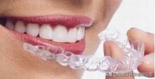 你的牙齿是否符合以上标准呢,你的牙齿够整齐吗