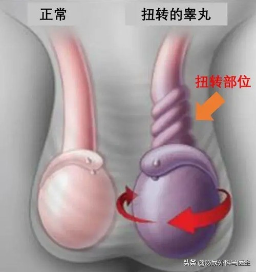 不是危言耸听,“蛋疼”真的能疼死人