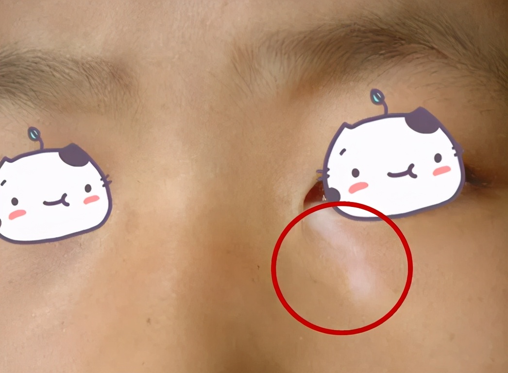 用了祛斑产品会得白癜风吗,用十多天就能变白祛斑的护肤品