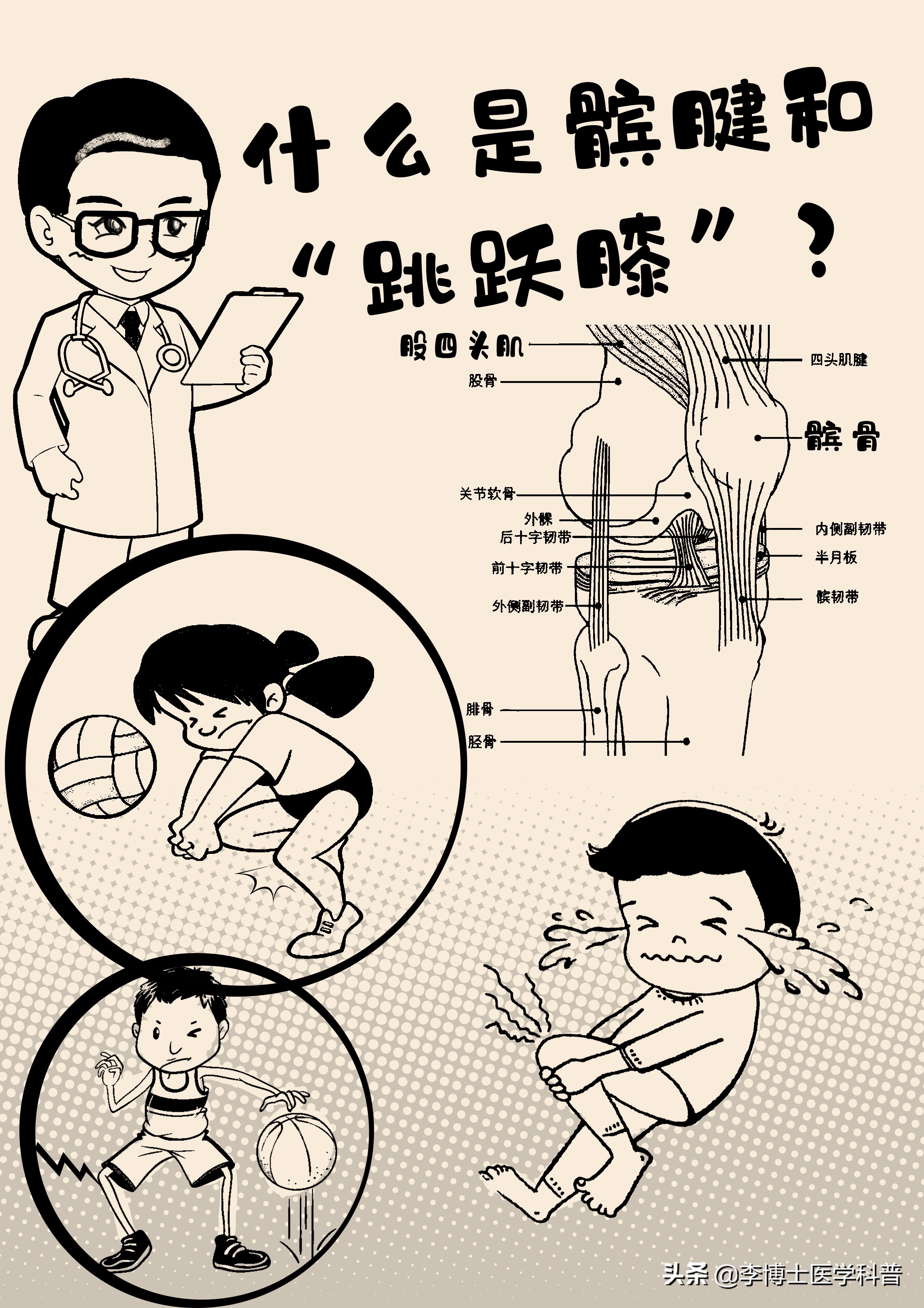 膝关节疼痛是关节炎吗,膝盖疼痛是不是髌腱炎