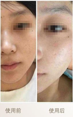 有人天生皮肤很黑然后怎么变白呢,天生皮肤黑怎么调理能变白