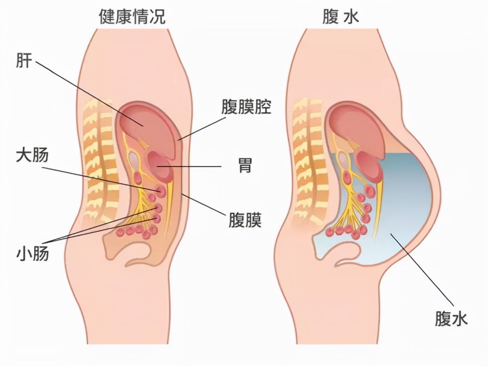 捐卵黑幕,捐卵骗局真人
