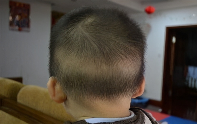 宝宝缺钙怎么补救最有效,宝宝缺钙怎么办怎么补最有效