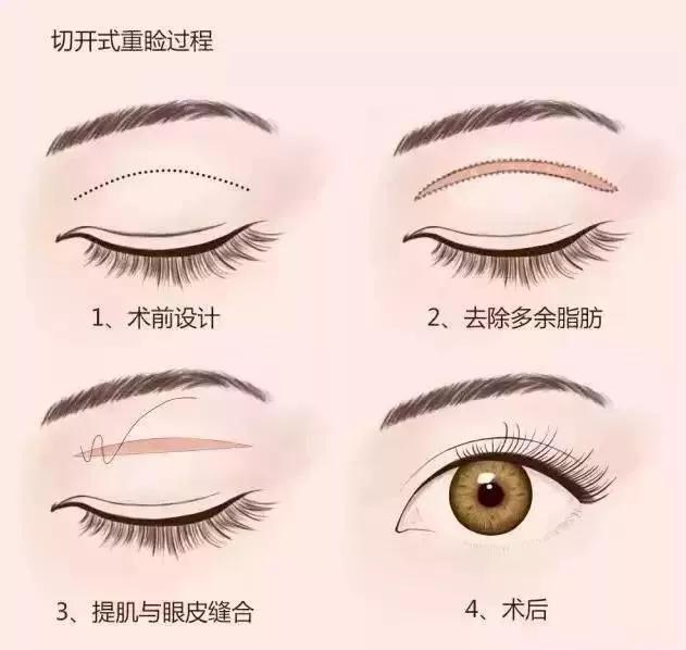 从丑小鸭到白天鹅的经历了什么,从丑小鸭到白天鹅蜕变