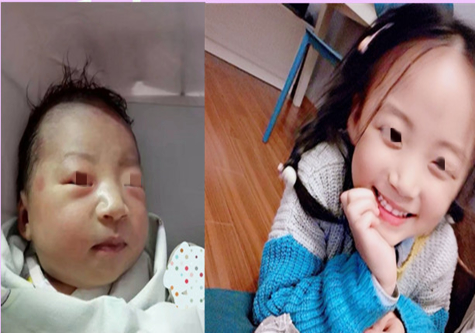 女大十八变真实长相,女大十八变孩子五官几岁定型