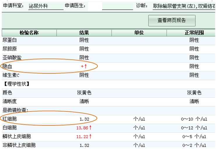 尿隐血为阳性为什么医生说没事,我的尿潜血偏高怎么治疗