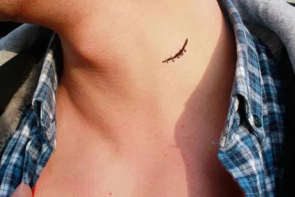 阿莫西林并非万能消炎药！不了解禁忌就乱用，容易伤身体