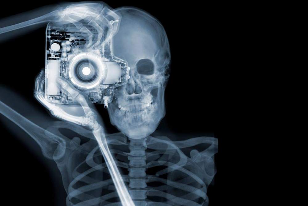 握手、亲吻、喝水、高跟鞋！X射线下人体的样子是啥样？