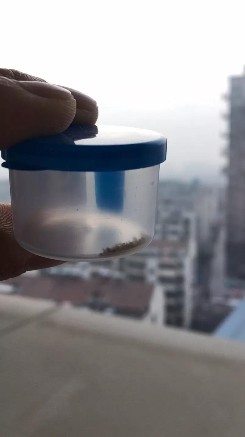 小儿尿道结石如何碎石,小儿尿结石