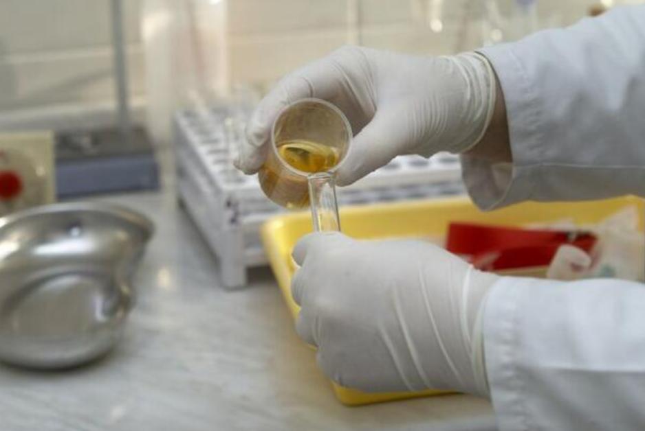 发现小便颜色不对,尿尿颜色不对查什么科