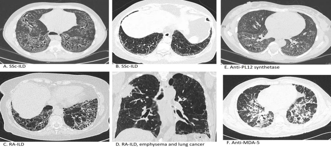 代华平视频,中日友好医院代华平