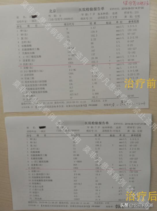 如何确诊儿童肾功能不全,儿童肾功能不全能治好吗