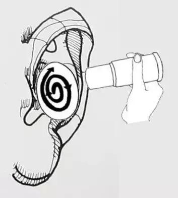 青少年近视艾灸哪些穴位,赵氏雷火灸治近视