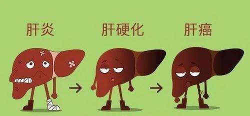 中西医治疗肝硬化,中西医结合治疗肝炎肝硬化