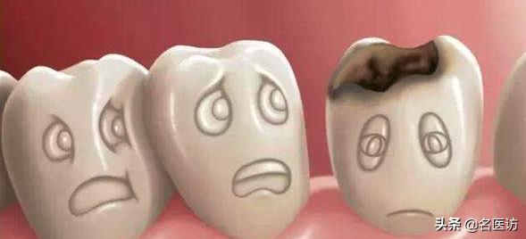 牙齿有洞拔牙好还是补牙好,儿童牙齿烂洞等换牙还是补牙呢