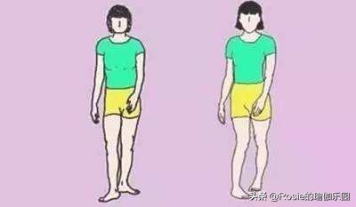 大腿根缝隙大o型腿怎么矫正,穿软鞋子造成o型腿怎么矫正