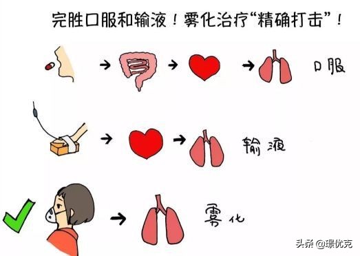 孩子咳嗽有痰吃药雾化也不好,孩子咳嗽做了雾化还要吃药吗