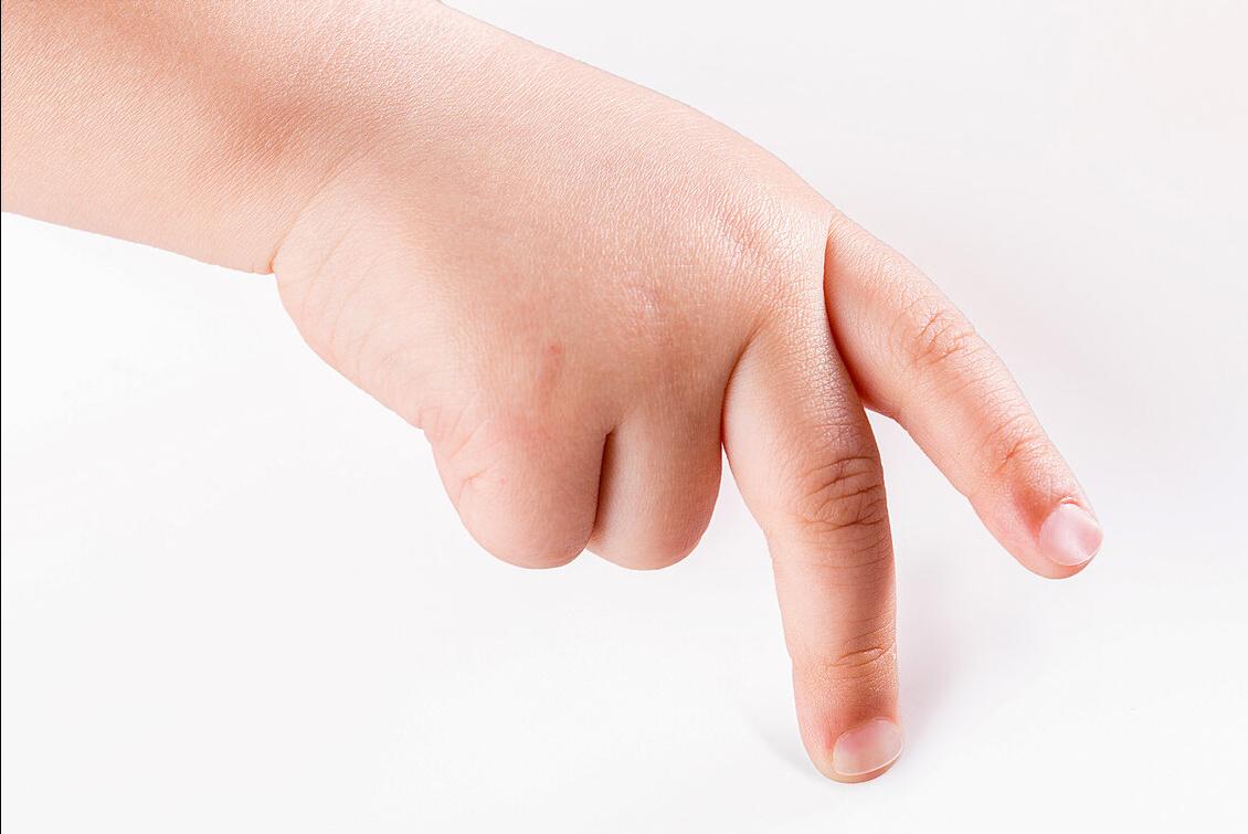 小孩没有得手足口病脱甲怎么回事,5岁小孩突然脱指甲怎么回事