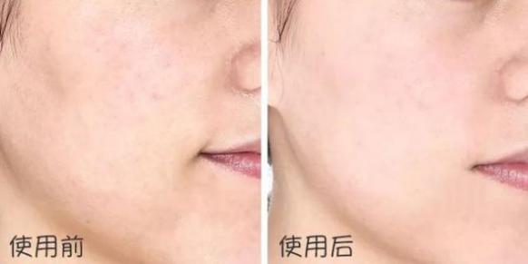 澳大利亚财政部长首推品牌，进国后让柳岩薇娅同时着迷，太疯狂了