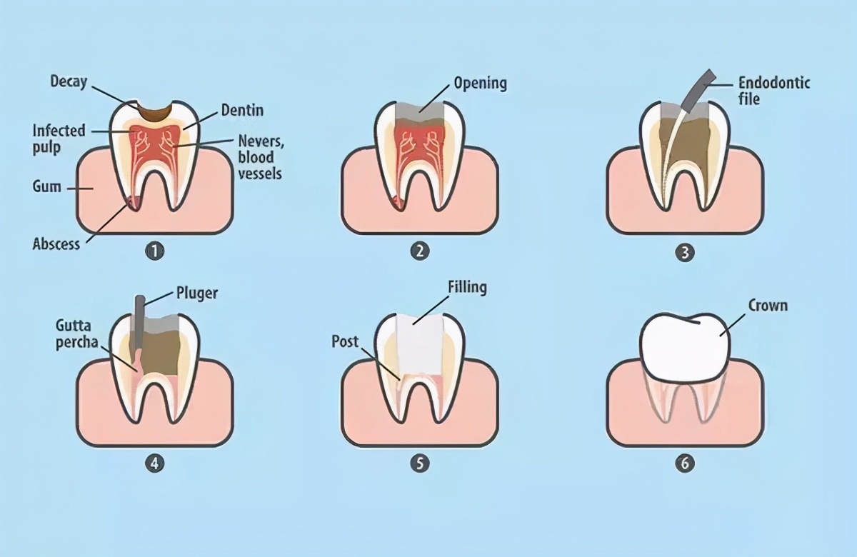 大连齿医生口腔补牙洞视频,大连牙科医生牙齿缺失怎么办
