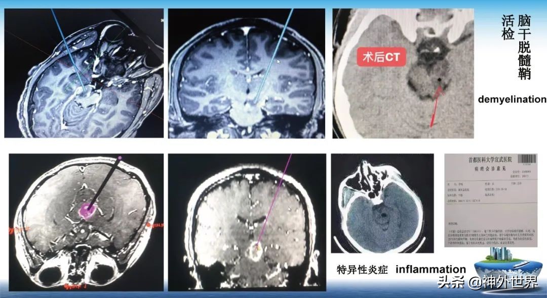 宣武医院神经外科王亚明祖籍,北京宣武医院神经科专家王亚明