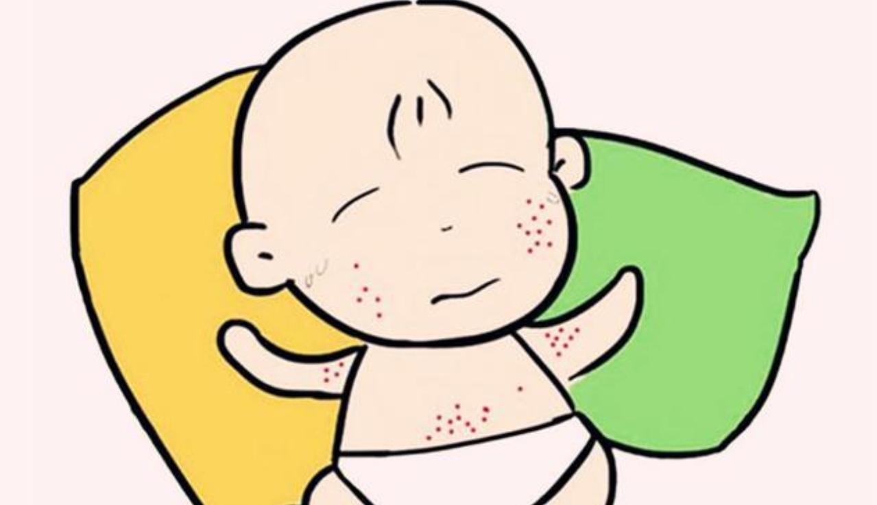 宝宝背后有疹子是什么疹子,宝宝出疹子会有什么疹子