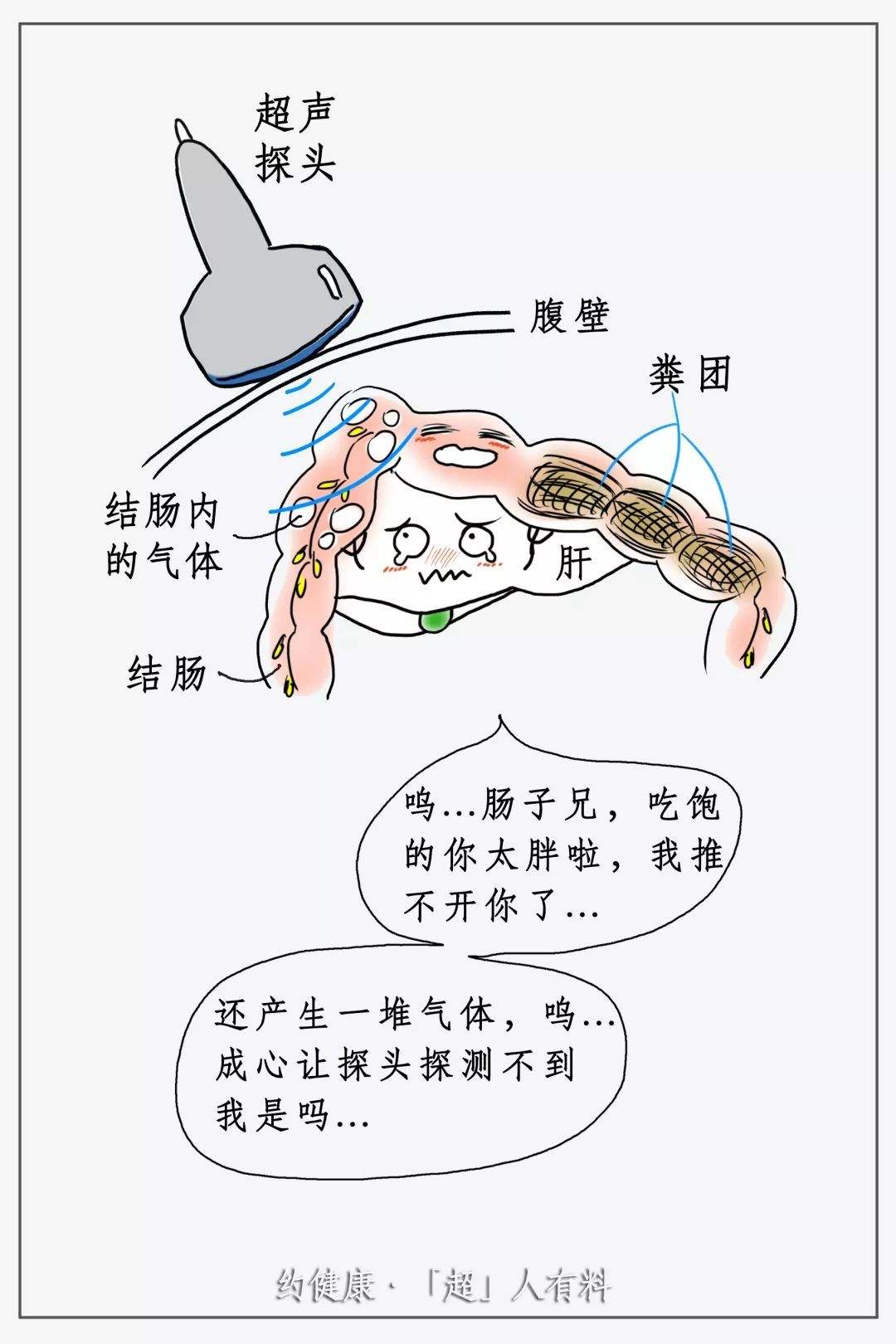 超声检查前的准备工作有哪些,做超声内镜前怎么准备