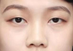 素人改造无眉毛烟熏妆,素人改造化妆遮颧骨