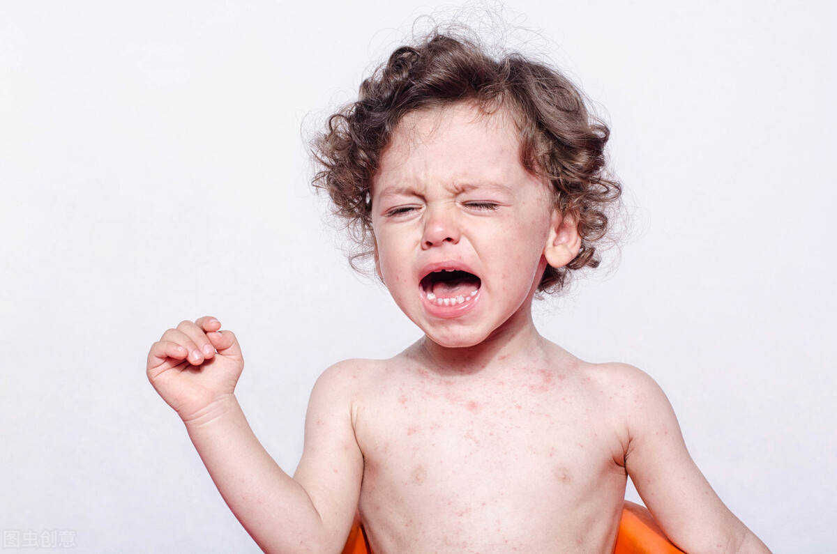 蚊虫叮咬几天不好需要吃解毒药吗,蚊虫叮咬的一般都是什么症状