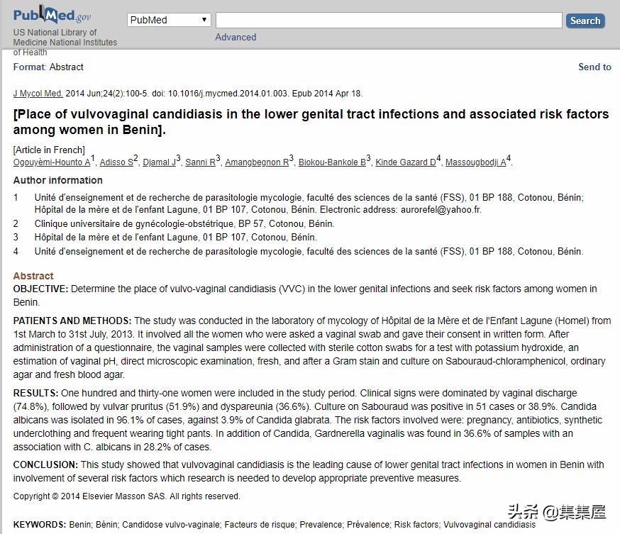 关于内衣的一些刁钻问题,内衣有趣科普
